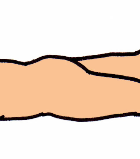 股関節伸筋（大殿筋）の筋力強化