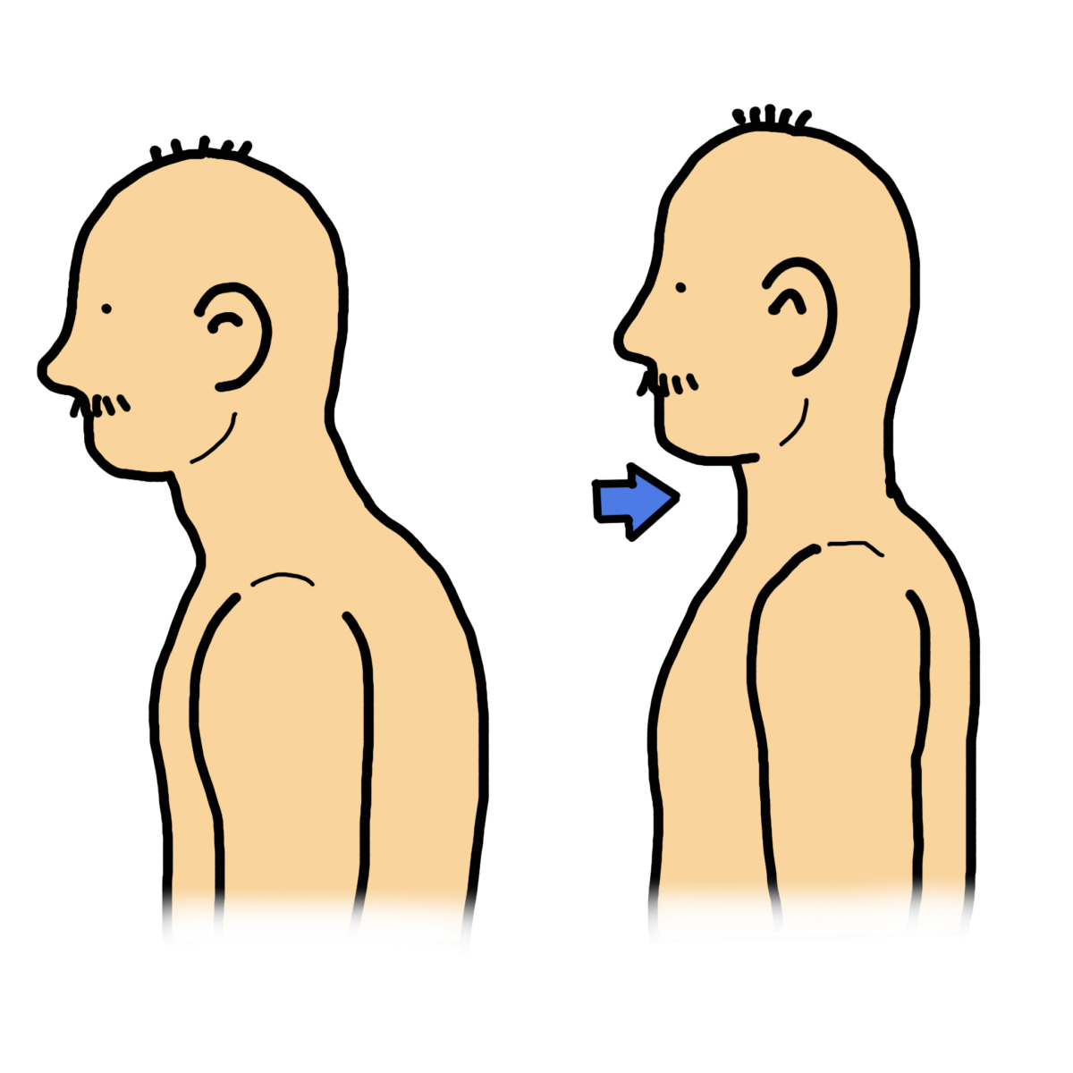 チン・イン　エクササイズ