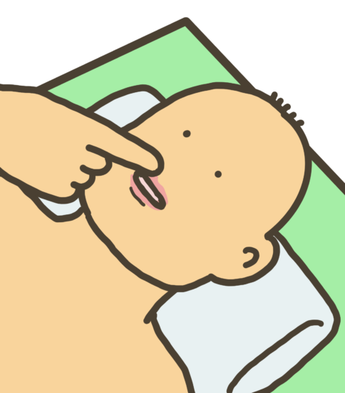 【脳性麻痺児の脱感作】その3（口周囲の対応について）
